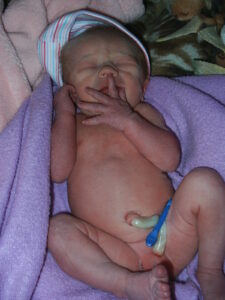 twin unassisted birth