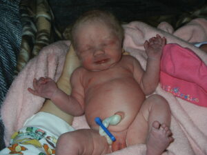 unassisted twin birth